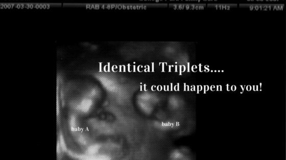 Identical Triplets - It Could Happen to You!