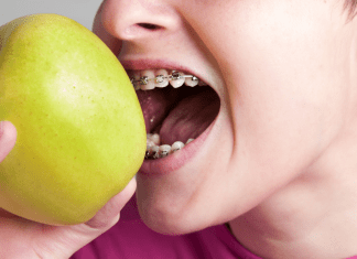 mouth with braces eating apple